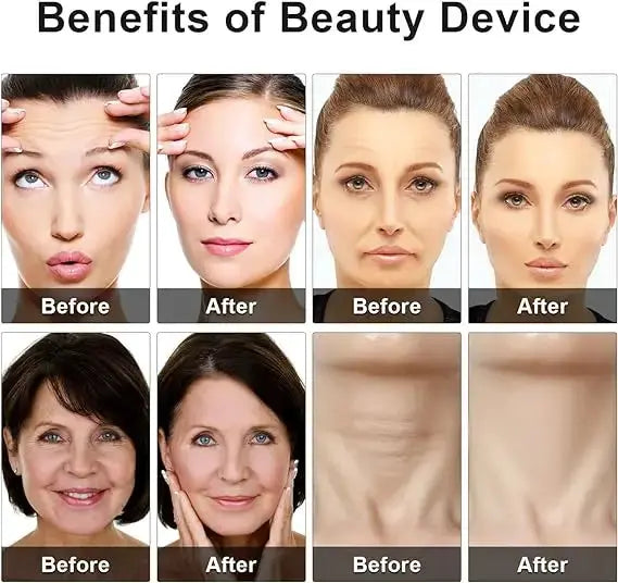 Eye Beauty Device Uae Mart